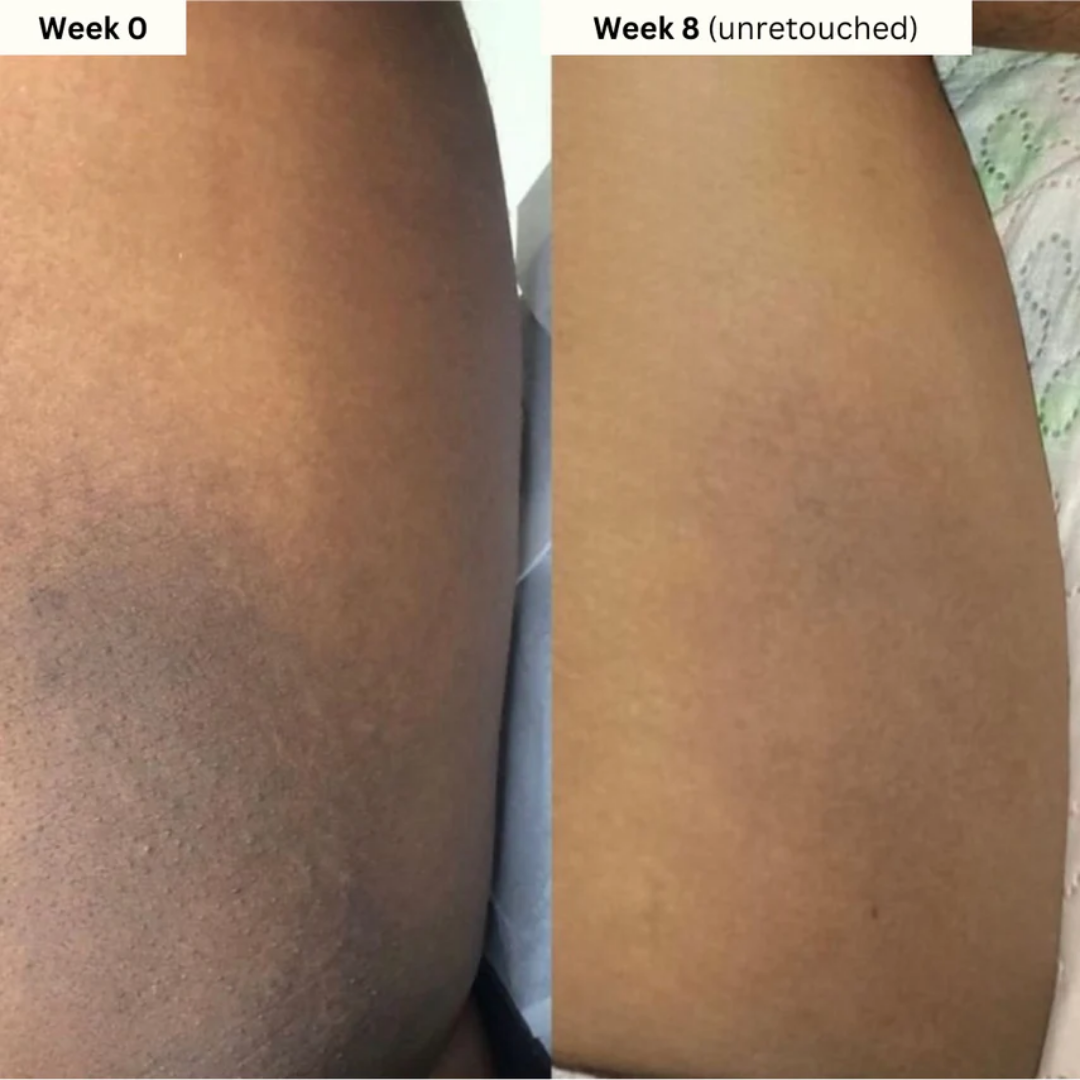 Turmeric & Kojic Acid Brightening Soap