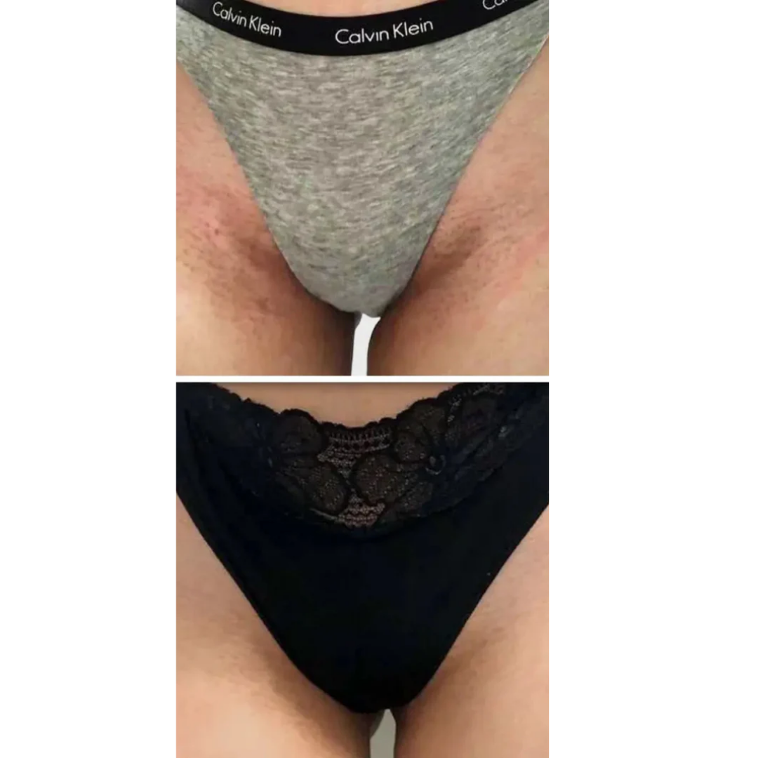 Turmeric & Kojic Acid Brightening Soap