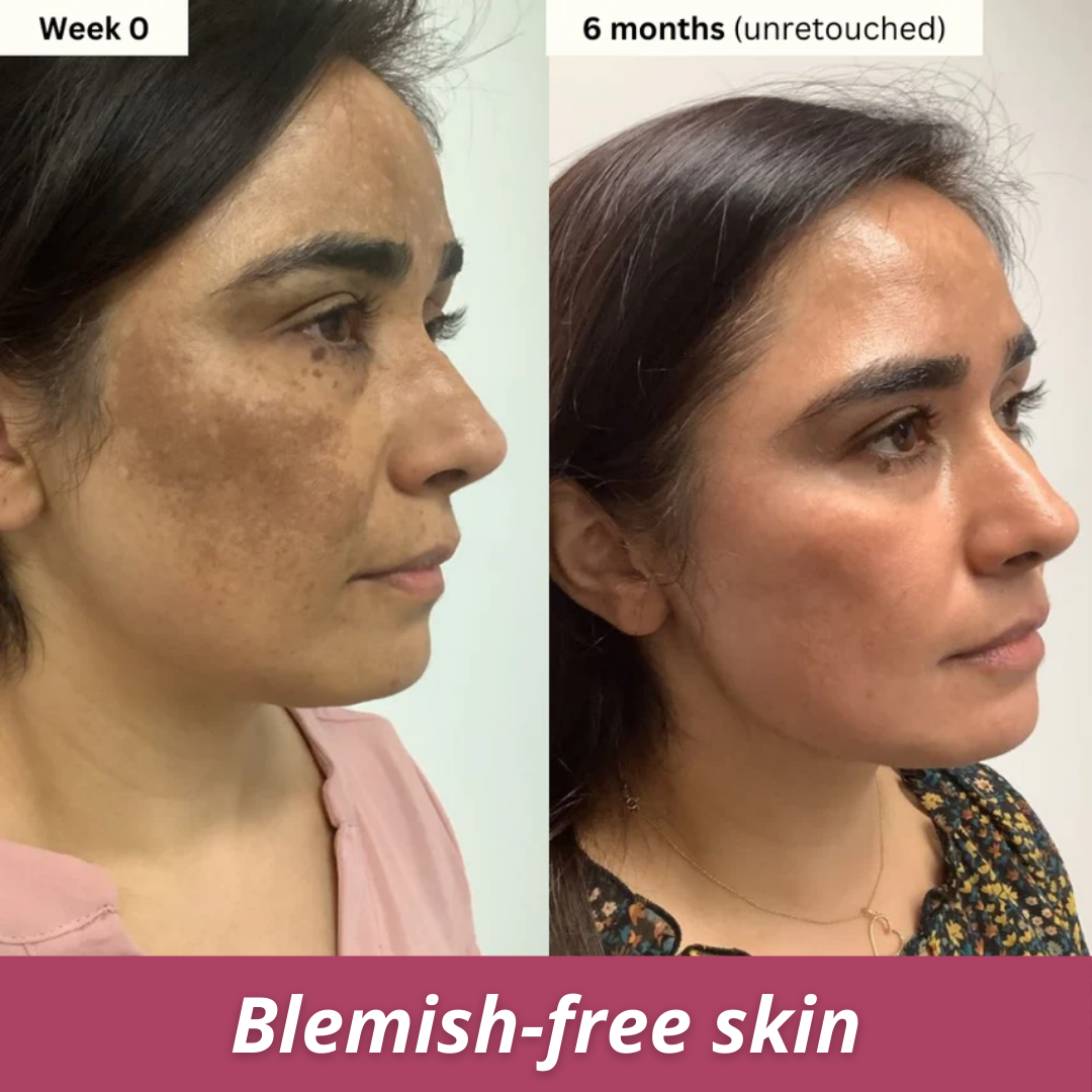 Turmeric & Kojic Acid Brightening Soap