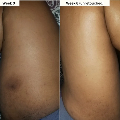 Turmeric & Kojic Acid Brightening Soap