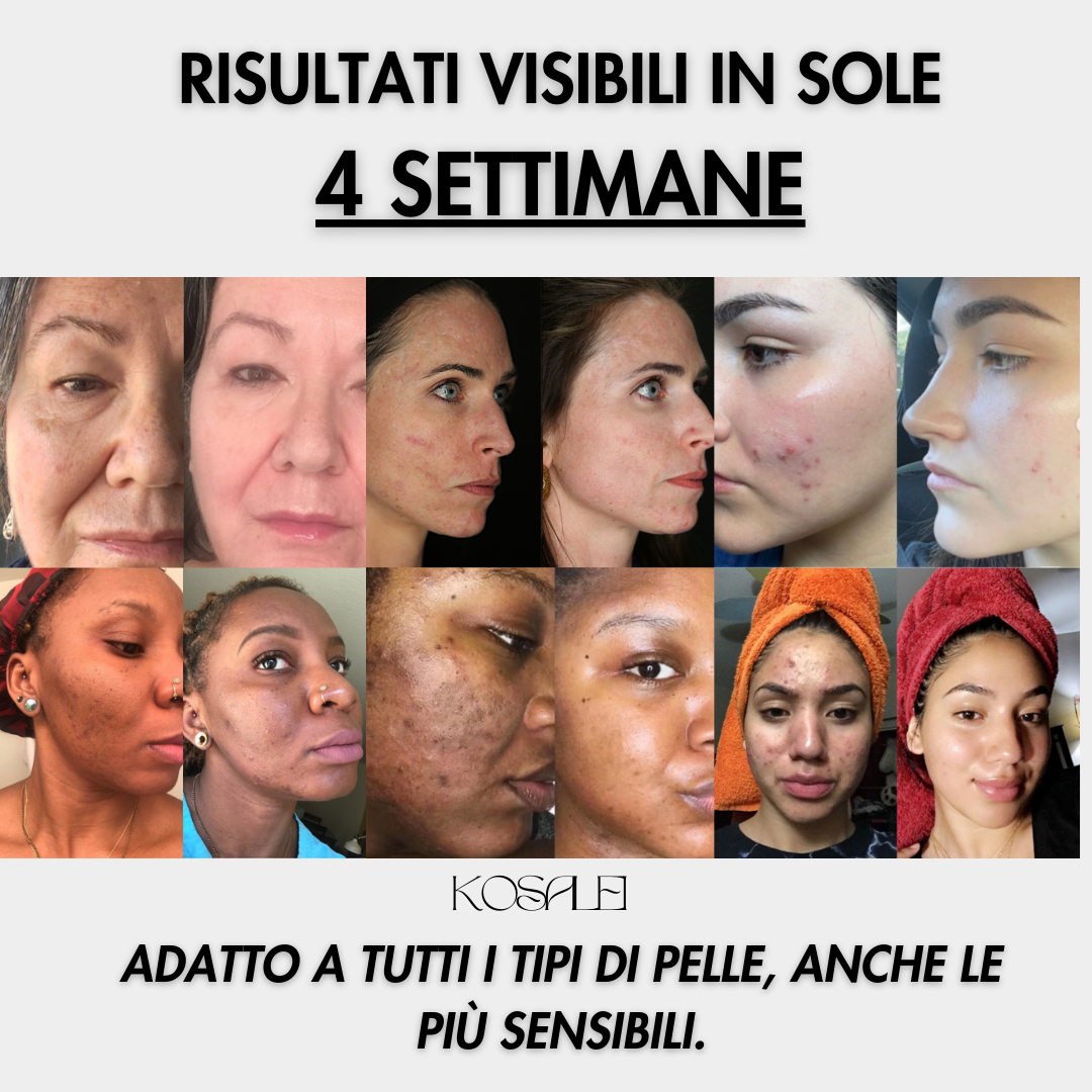 Dischetti Glow Up - Dischetti dermo-illuminanti alla Curcuma & Acido Cogico | 40 Dischetti