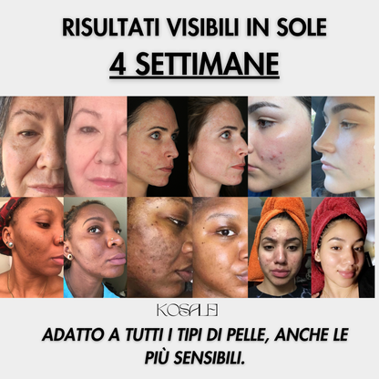 Dischetti Glow Up - Dischetti dermo-illuminanti alla Curcuma & Acido Cogico | 40 Dischetti