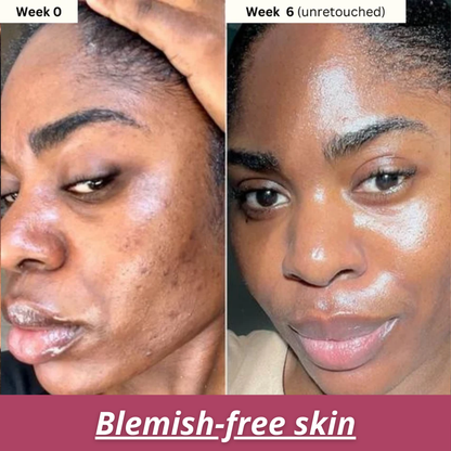 Turmeric & Kojic Acid Brightening Soap