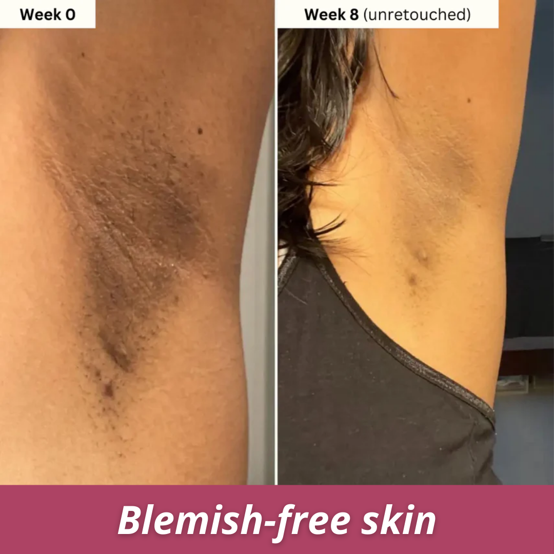 Turmeric & Kojic Acid Brightening Soap