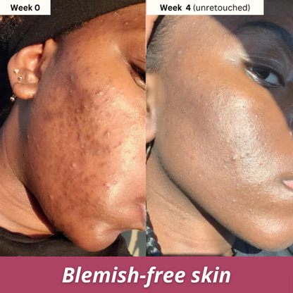 Turmeric & Kojic Acid Brightening Soap