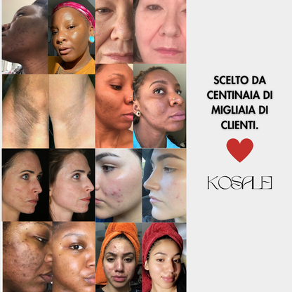 Dischetti Glow Up - Dischetti dermo-illuminanti alla Curcuma & Acido Cogico | 40 Dischetti